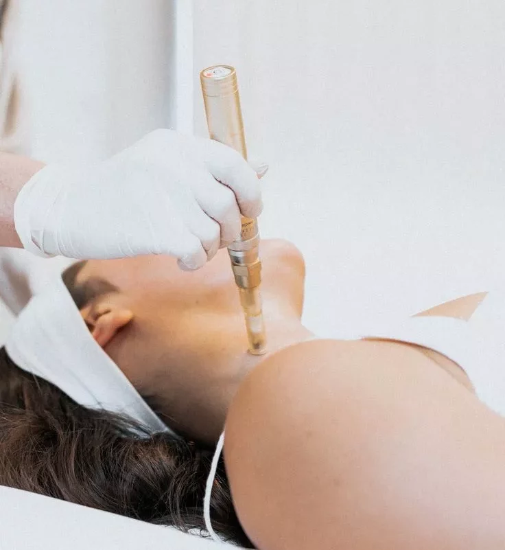 Microneedling : La Technique Révolutionnaire pour une Peau Jeune et Rayonnante